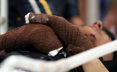 مرگ ۸ نفر در حوادث چهارشنبه سوری  ،  ۲۸ مورد قطع عضو