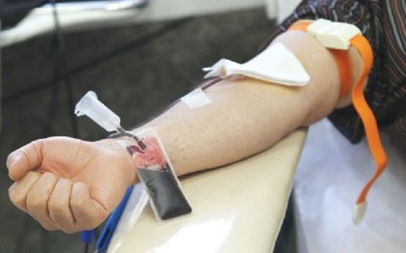 بیمه فصد و حجامت، موافقان و مخالفان چه می‌گویند