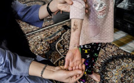 دولت آمریکا به پرداخت حدود ۷ میلیارد دلار خسارت به بیماران پروانه‌ای محکوم شد