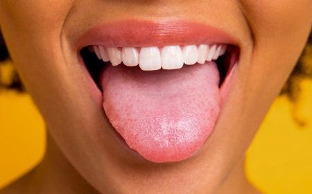 رنگ زبان درباره سلامتی شما چه می‌گوید؟