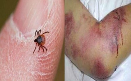 اوج فعالیت کنه‌ها در فصل گرما