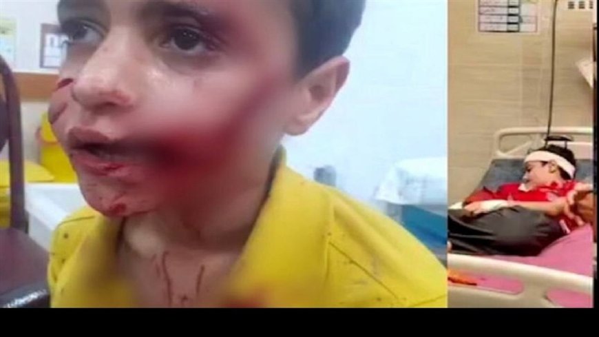 جان‌باختن کودک ۱۰ ساله در مسجدسلیمان بر اثر حمله سگ‌های ولگرد